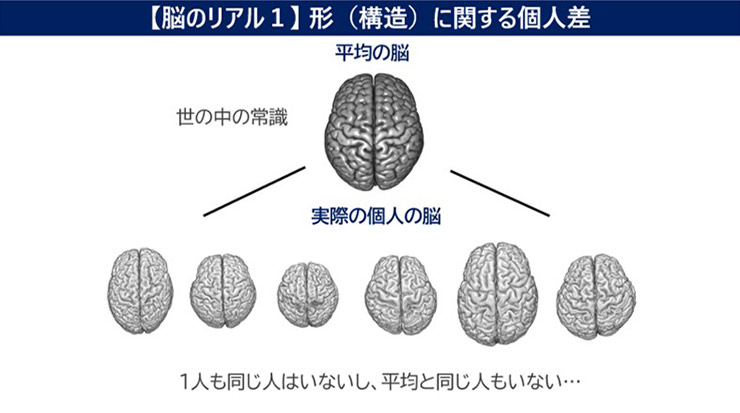 イメージ画像：【脳のリアル1】形（構造）に関する個人差